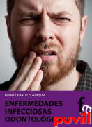 Enfermedades infecciosas odontolgicas